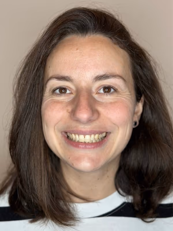 After Invisalign at Dental & Wellness London, Islington