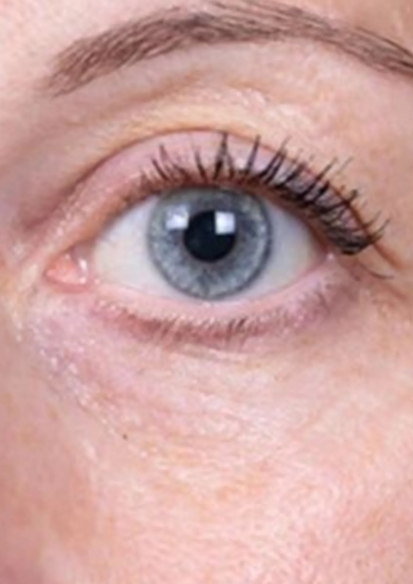 After skin redness treatment at Dental & Wellness London, Islington