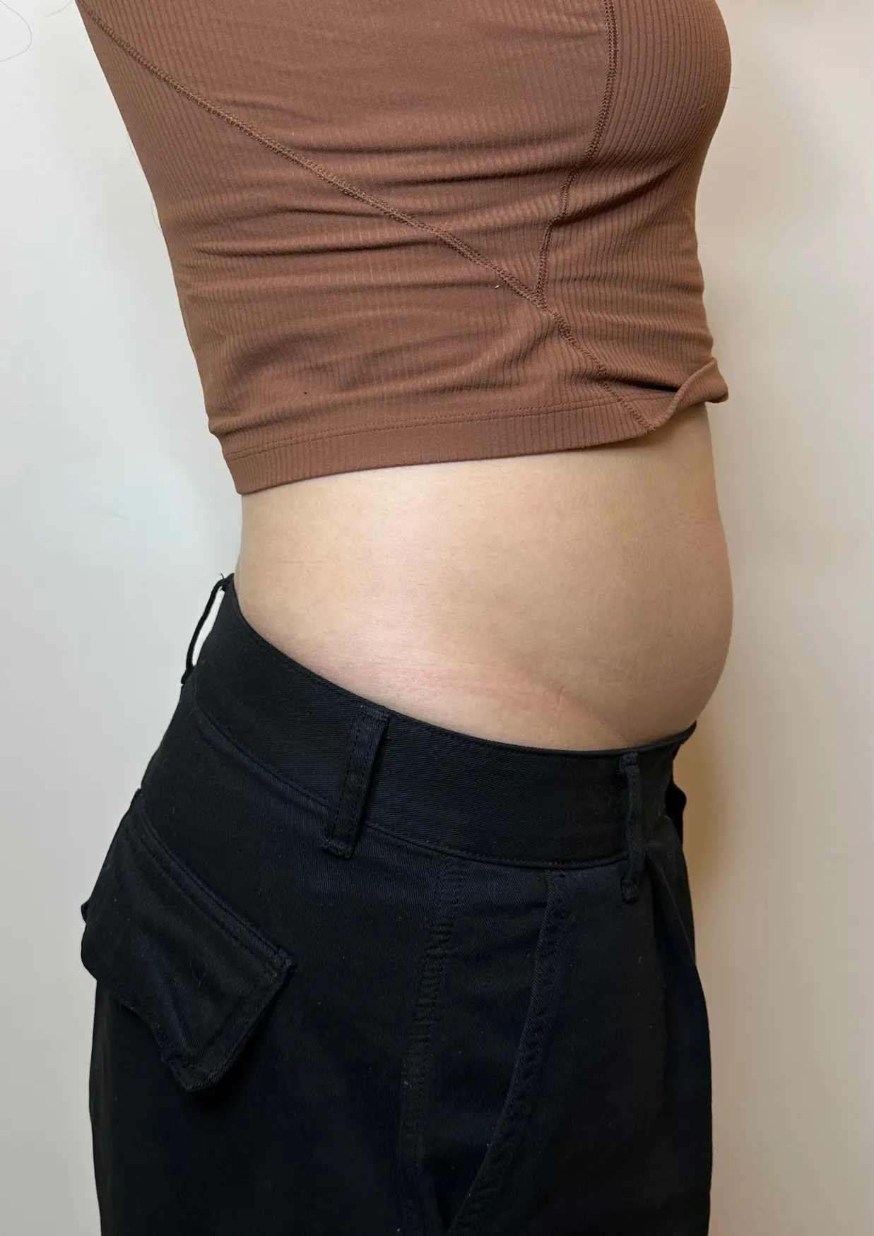 Before Onda body contouring at Dental & Wellness London, Islington