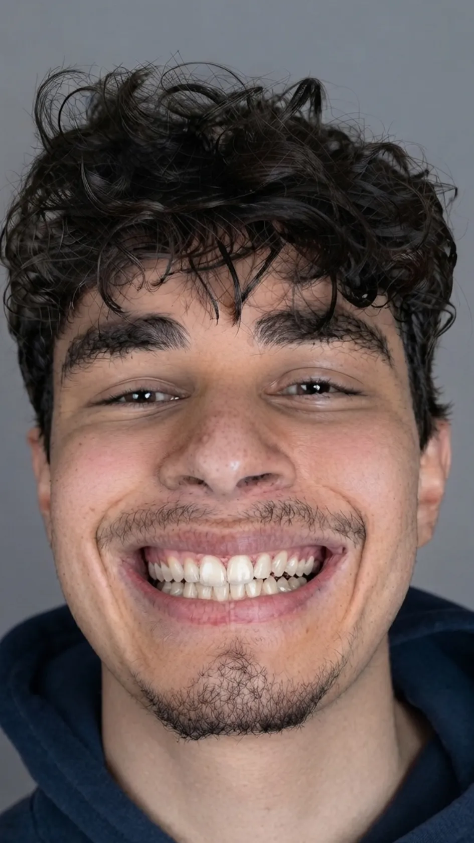 After Invisalign at Dental & Wellness London, Islington