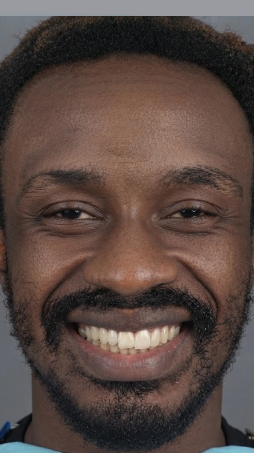 After teeth straightening at Dental & Wellness London, Islington