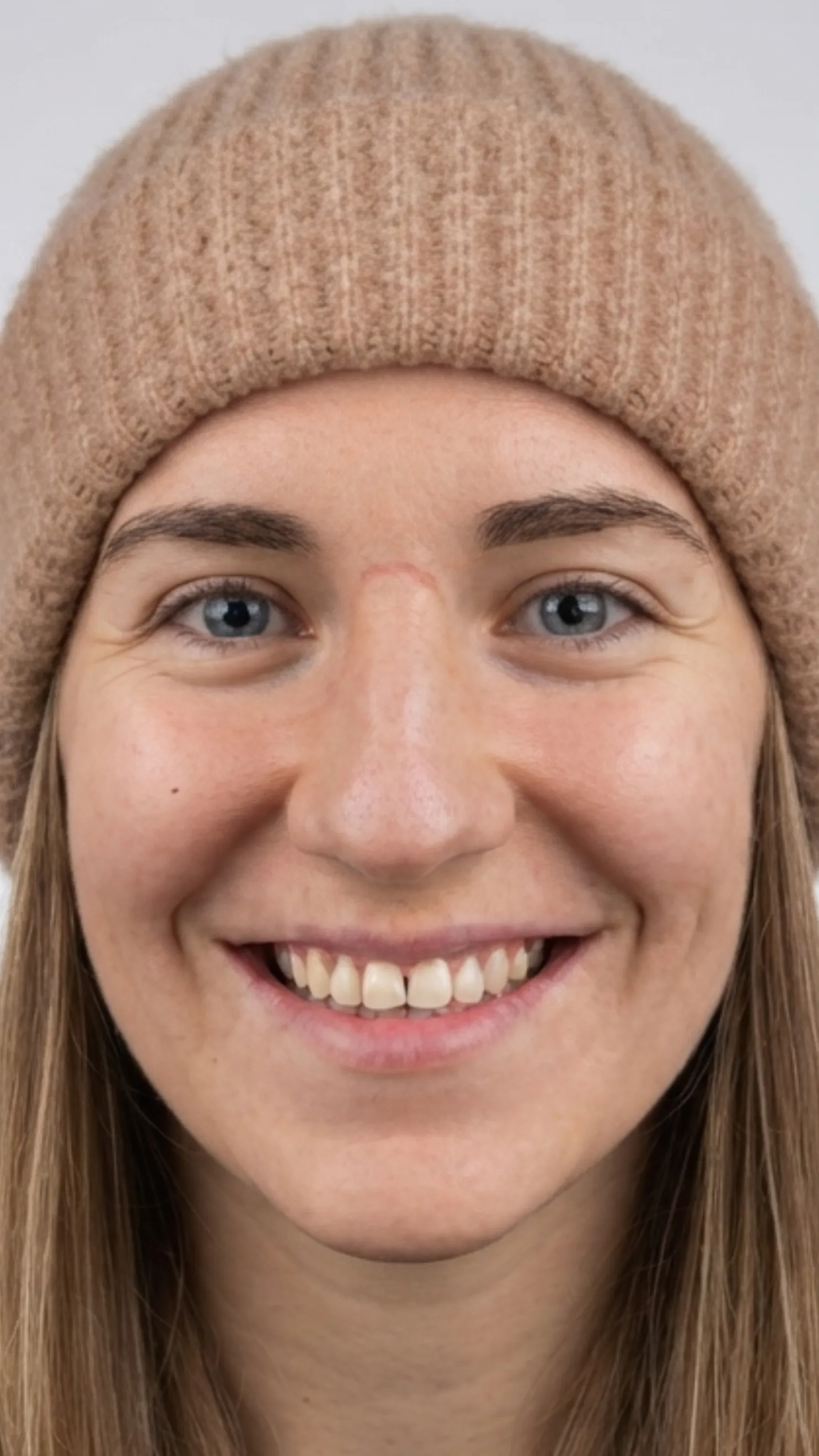 Before teeth whitening at Dental & Wellness London, Islington