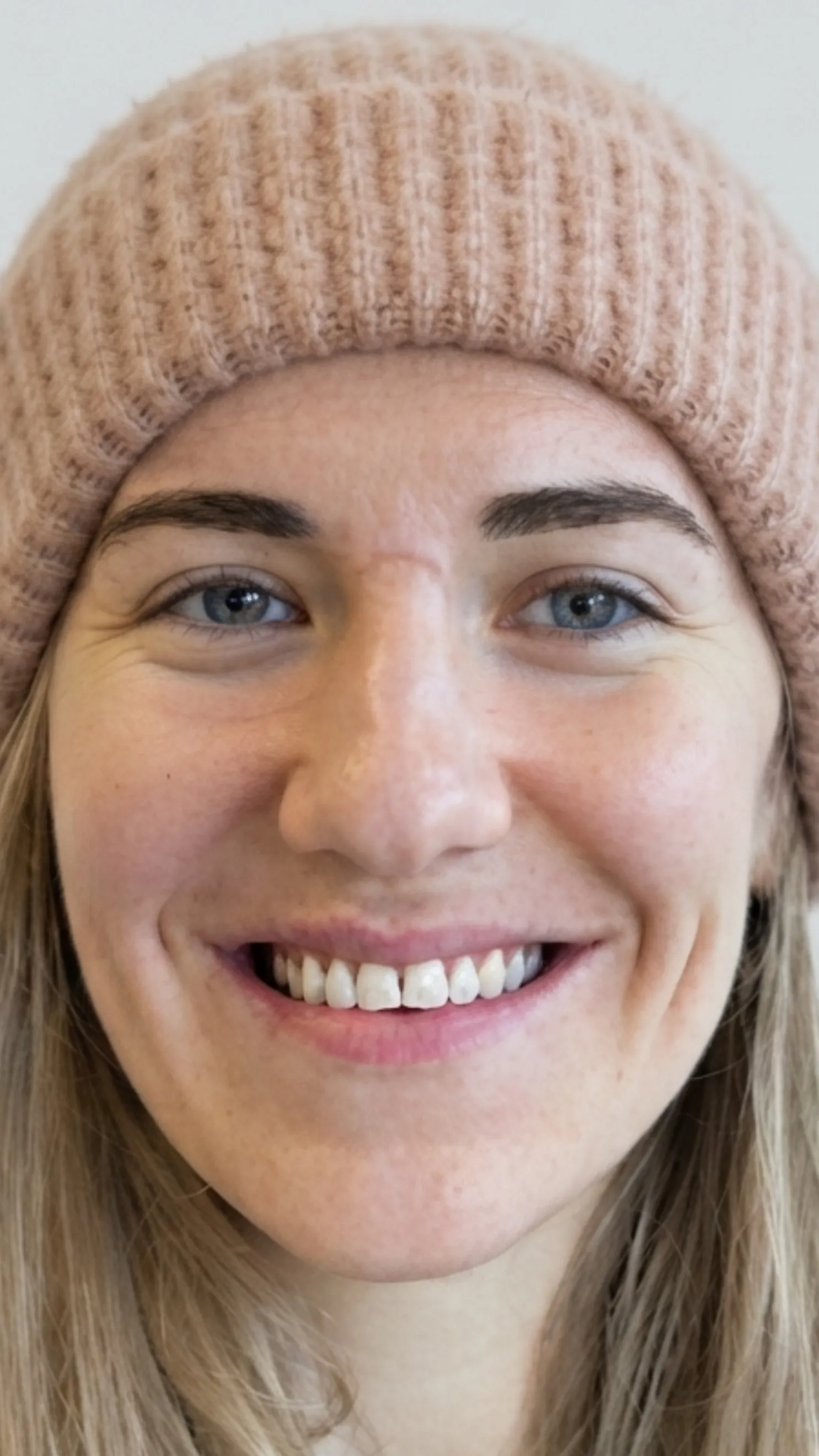 After teeth whitening at Dental & Wellness London, Islington