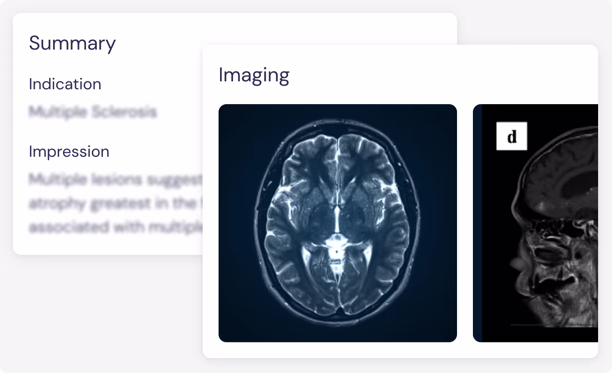 User interface showing brain MRI scans under an Imaging section, with a Summary section mentioning Multiple Sclerosis and impression text.