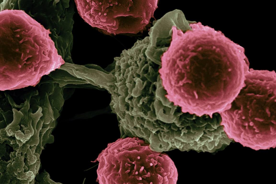 The next generation of cancer drugs will be made by AI