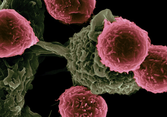 The next generation of cancer drugs will be made by AI