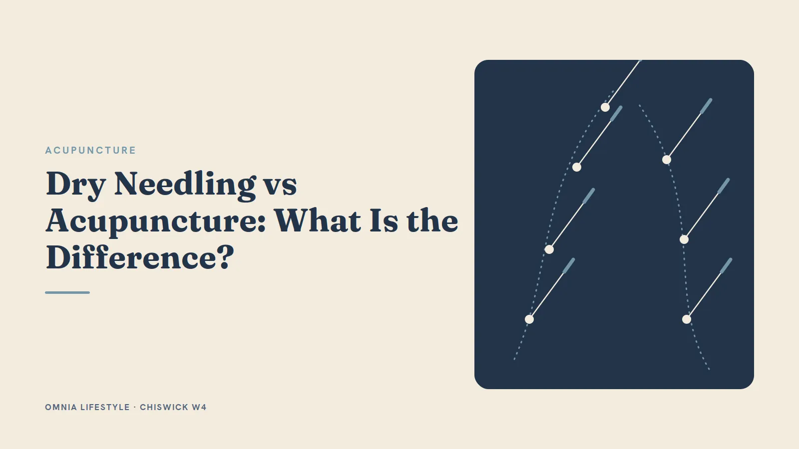 Dry Needling vs Acupuncture: What Is the Difference?