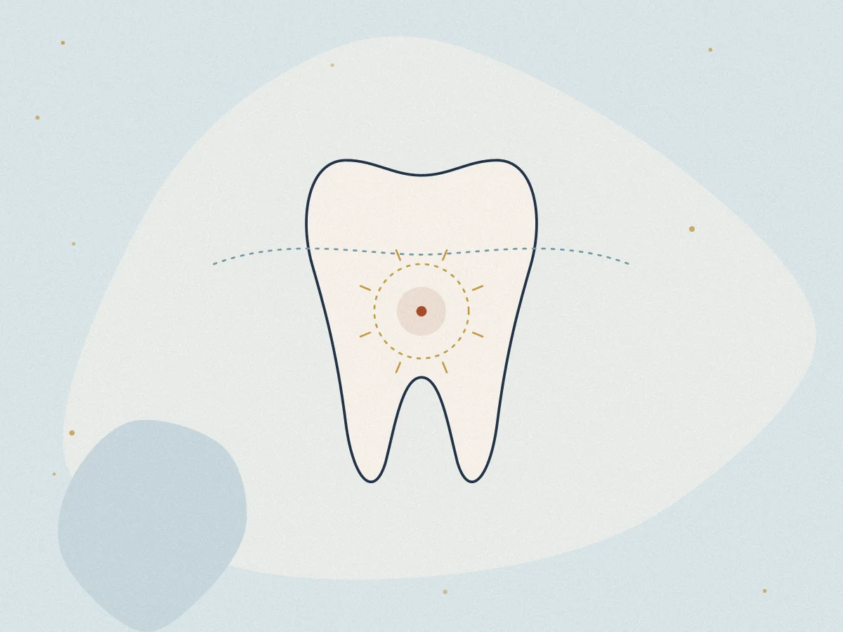 Toothache & Dental Pain treatment in Chiswick, London at Omnia Lifestyle
