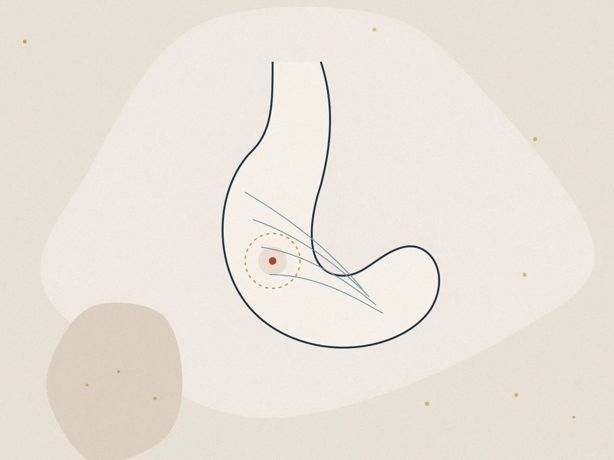 Stomach Ulcer treatment in Chiswick, London at Omnia Lifestyle