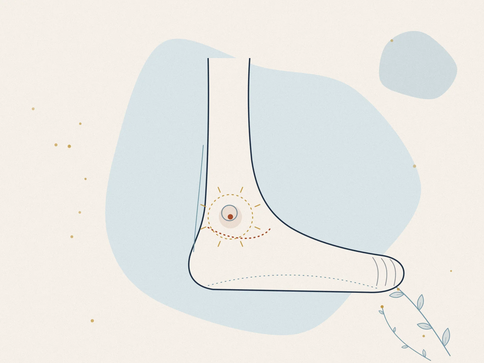Illustration of sprains & strains, treated at Omnia Lifestyle clinic in Chiswick, West London