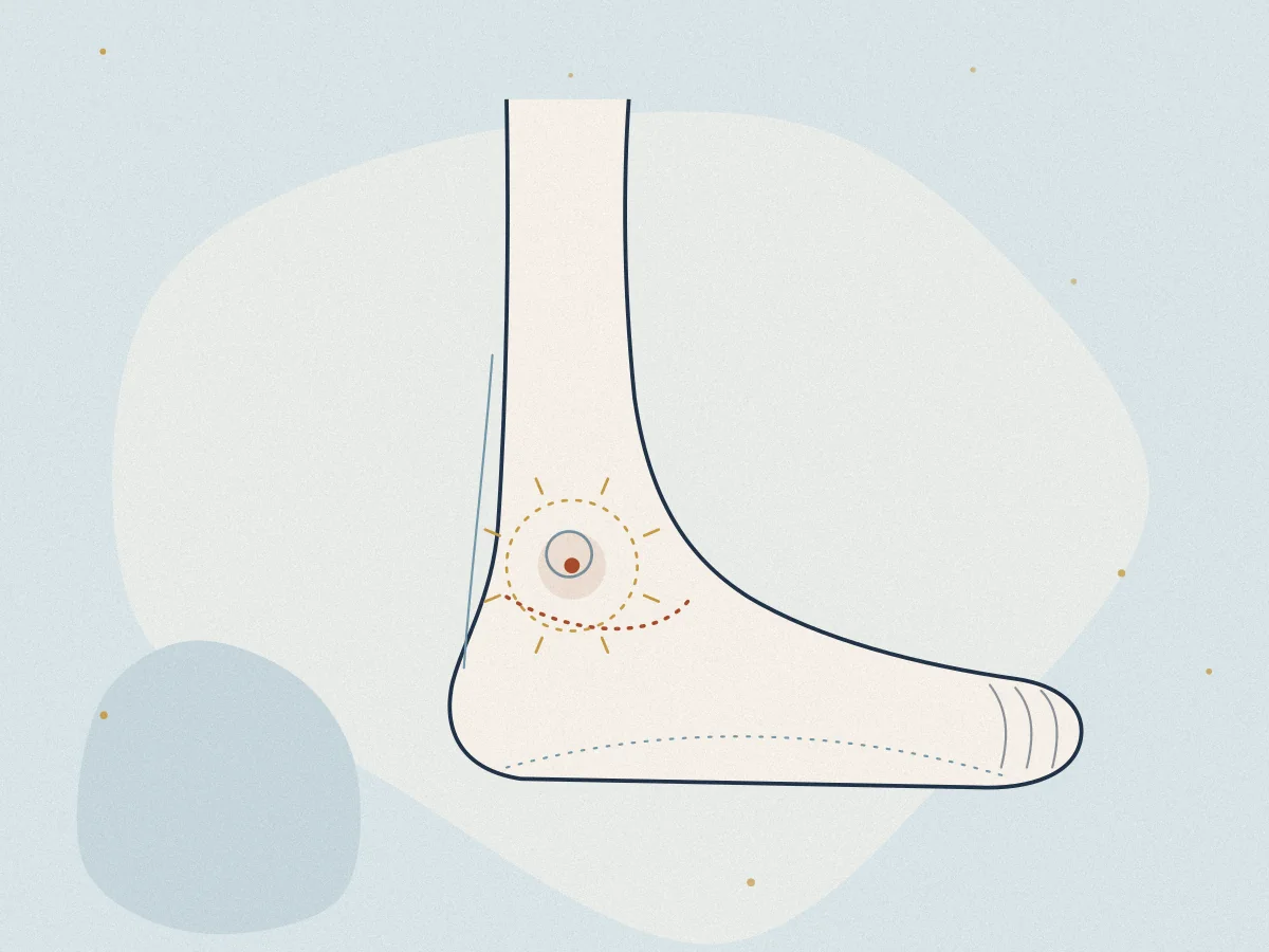 Sprains & Strains treatment in Chiswick, London at Omnia Lifestyle