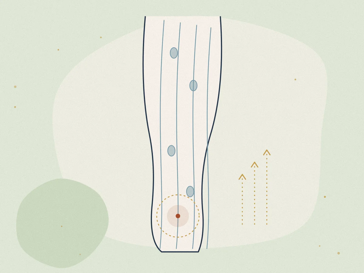Lymphoedema treatment in Chiswick, London at Omnia Lifestyle