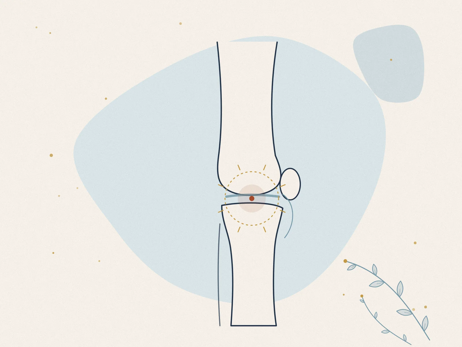 Illustration of knee pain, treated at Omnia Lifestyle clinic in Chiswick, West London