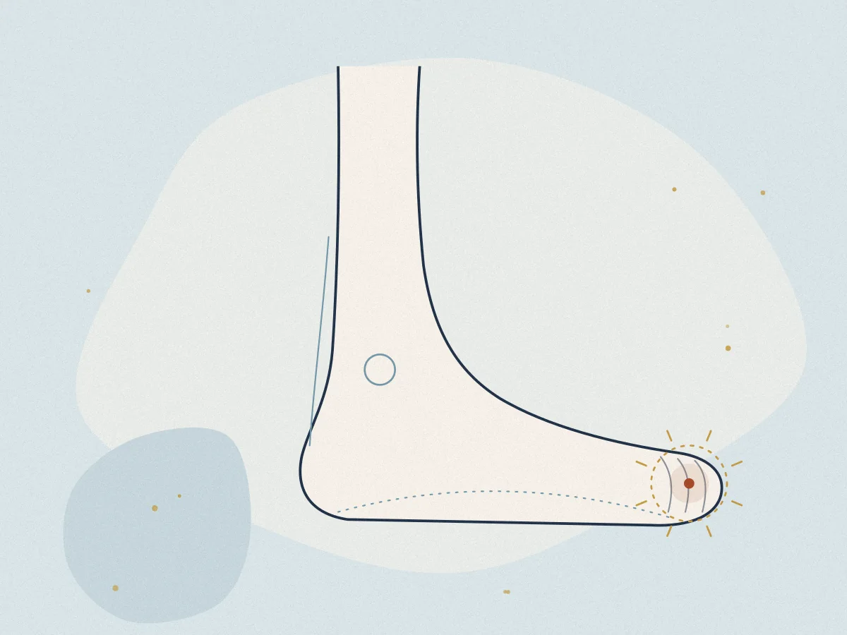 Gout treatment in Chiswick, London at Omnia Lifestyle