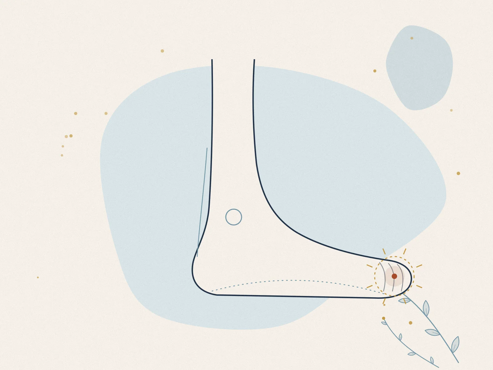 Illustration of gout, treated at Omnia Lifestyle clinic in Chiswick, West London