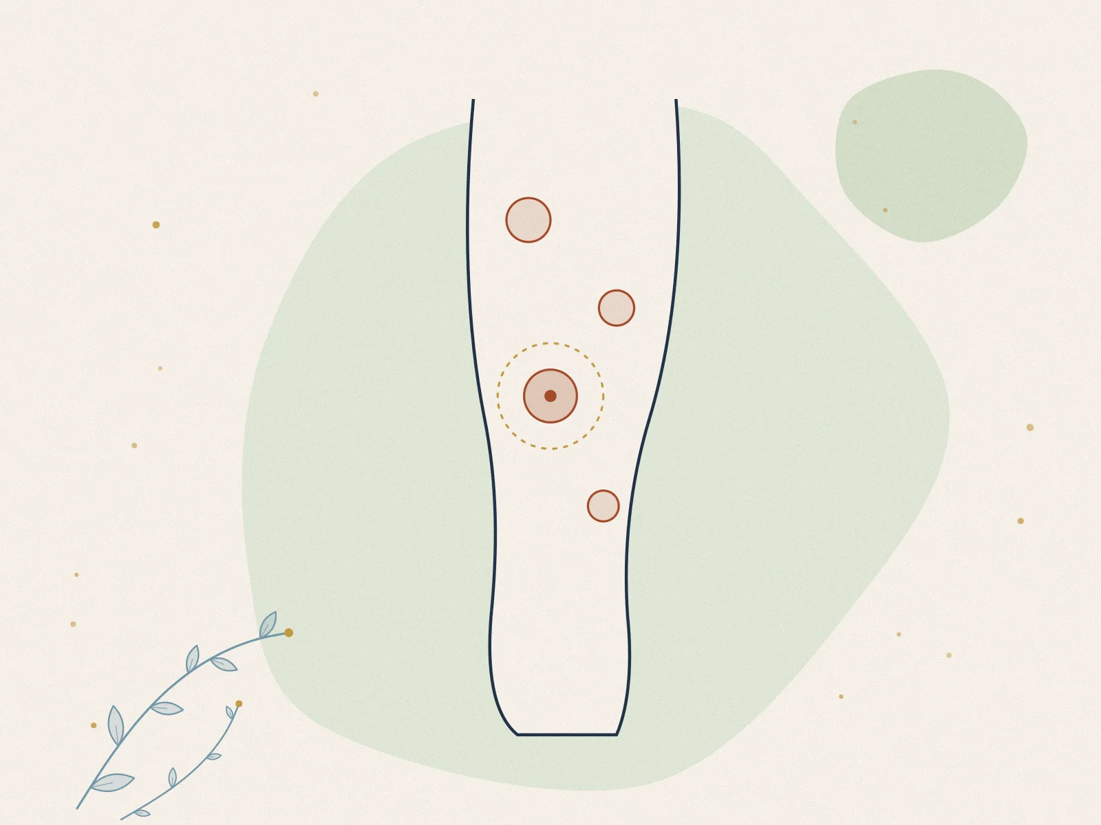 Illustration of dercum's disease, treated at Omnia Lifestyle clinic in Chiswick, West London