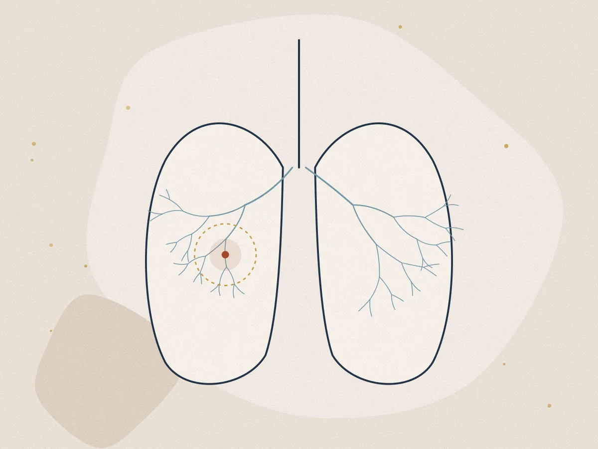 Asthma treatment in Chiswick, London at Omnia Lifestyle