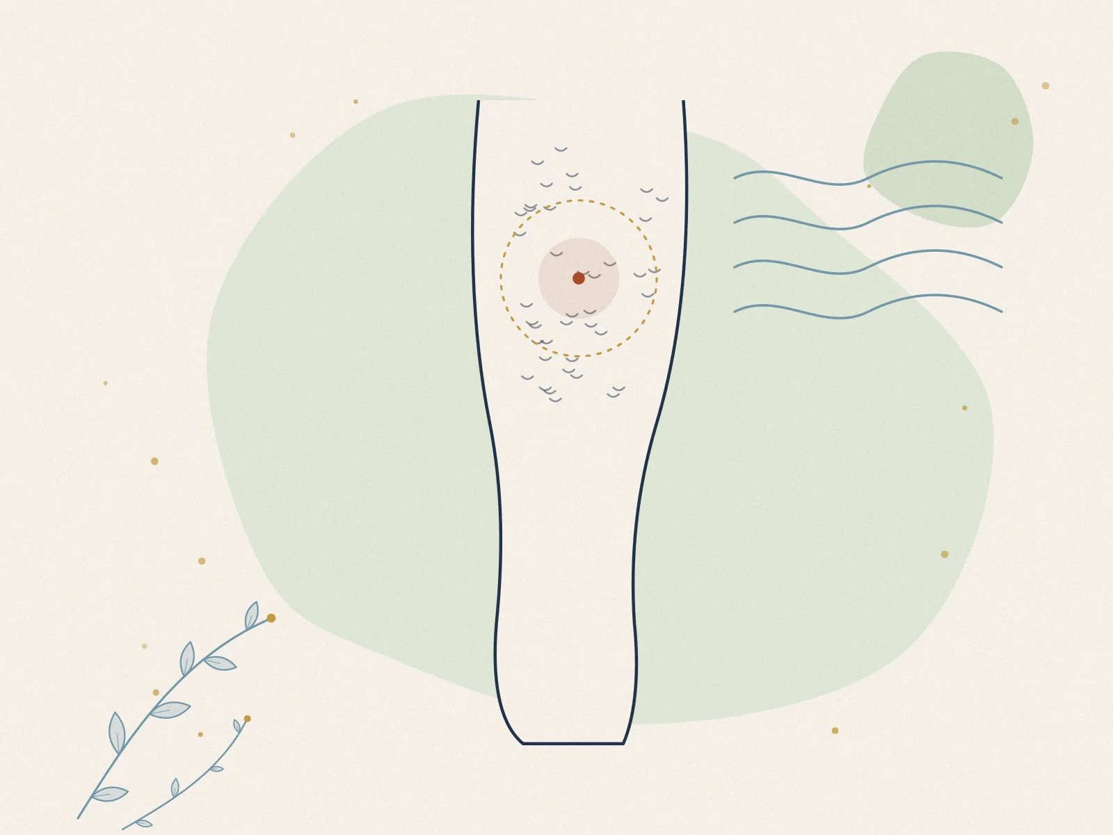 Illustration of cellulite reduction, treated at Omnia Lifestyle clinic in Chiswick, West London