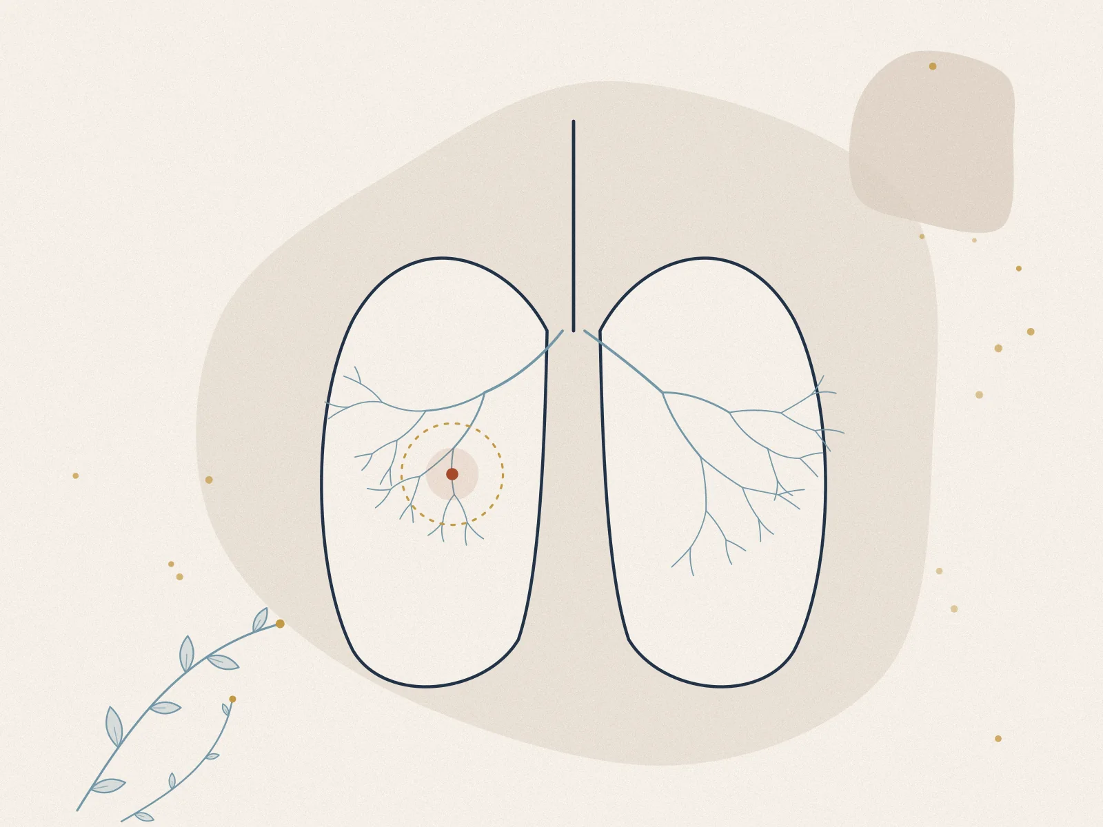 Illustration of asthma, treated at Omnia Lifestyle clinic in Chiswick, West London