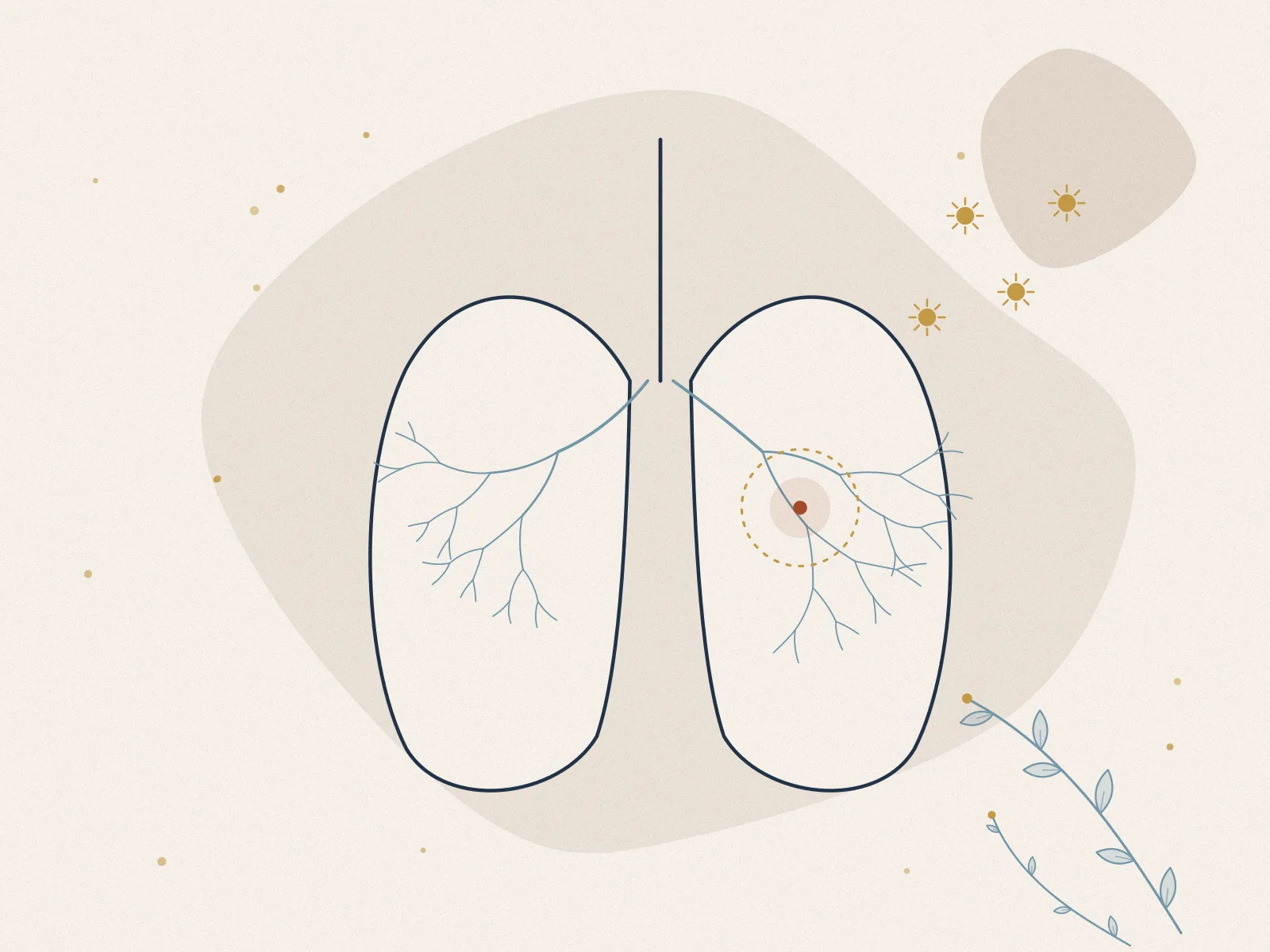 Illustration of allergy, treated at Omnia Lifestyle clinic in Chiswick, West London