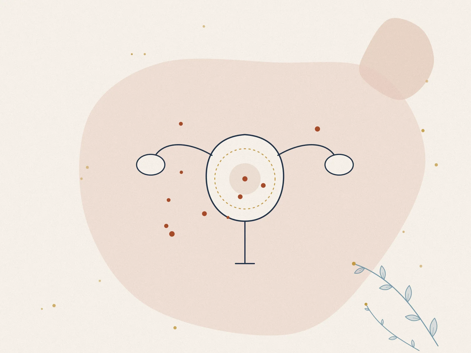 Illustration of endometriosis, treated at Omnia Lifestyle clinic in Chiswick, West London