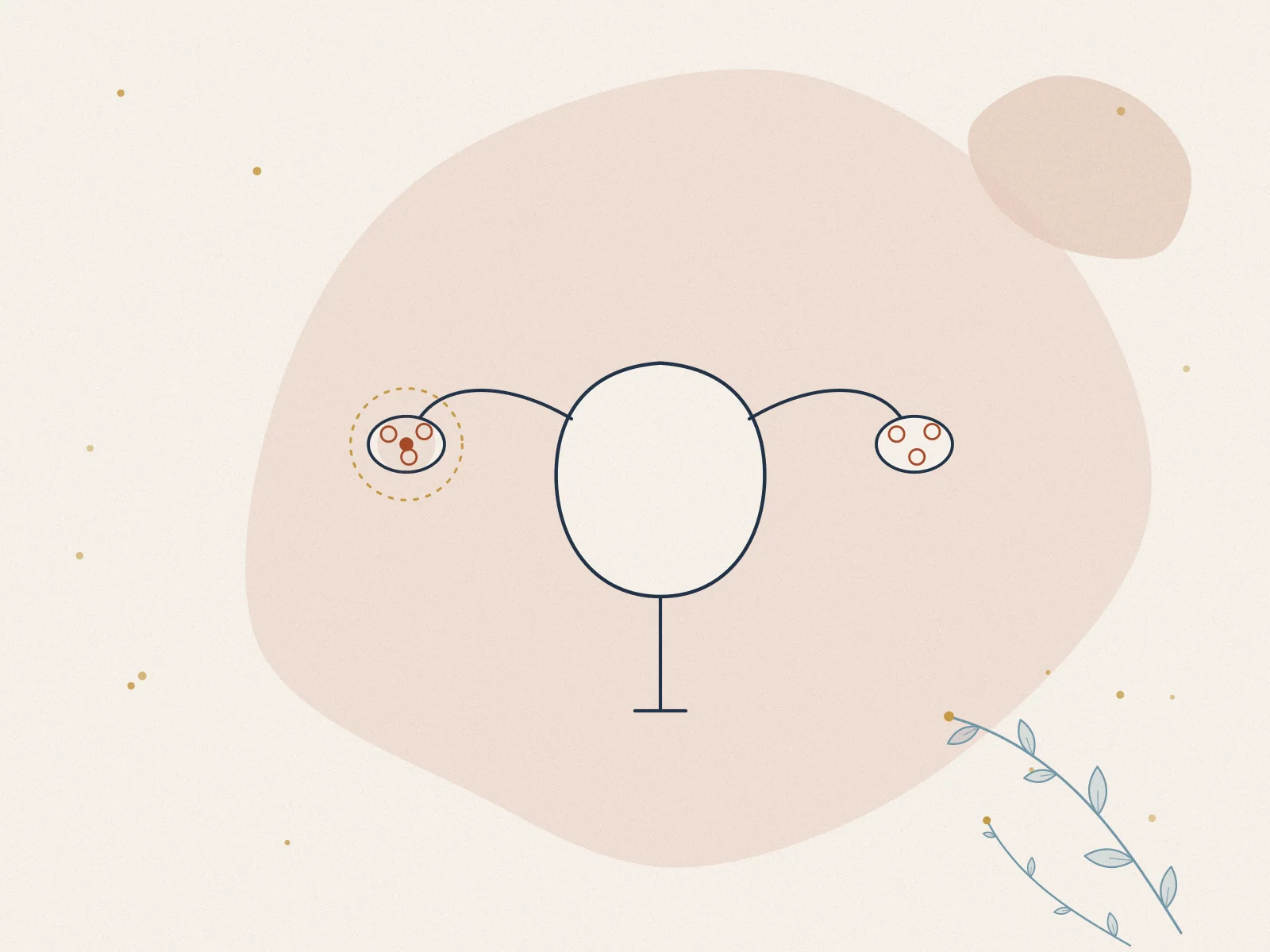 Illustration of PCOS (polycystic ovary syndrome), treated at Omnia Lifestyle clinic in Chiswick, West London