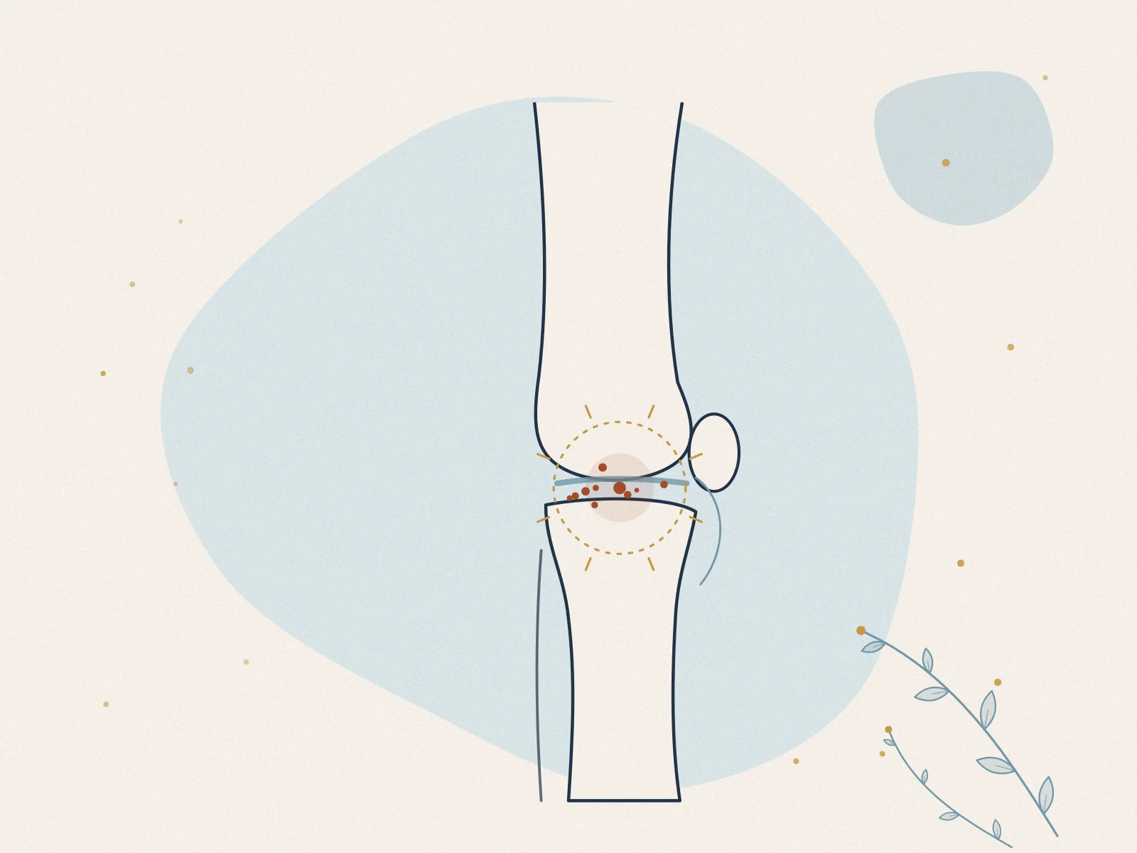 Illustration of joint pain, treated at Omnia Lifestyle clinic in Chiswick, West London
