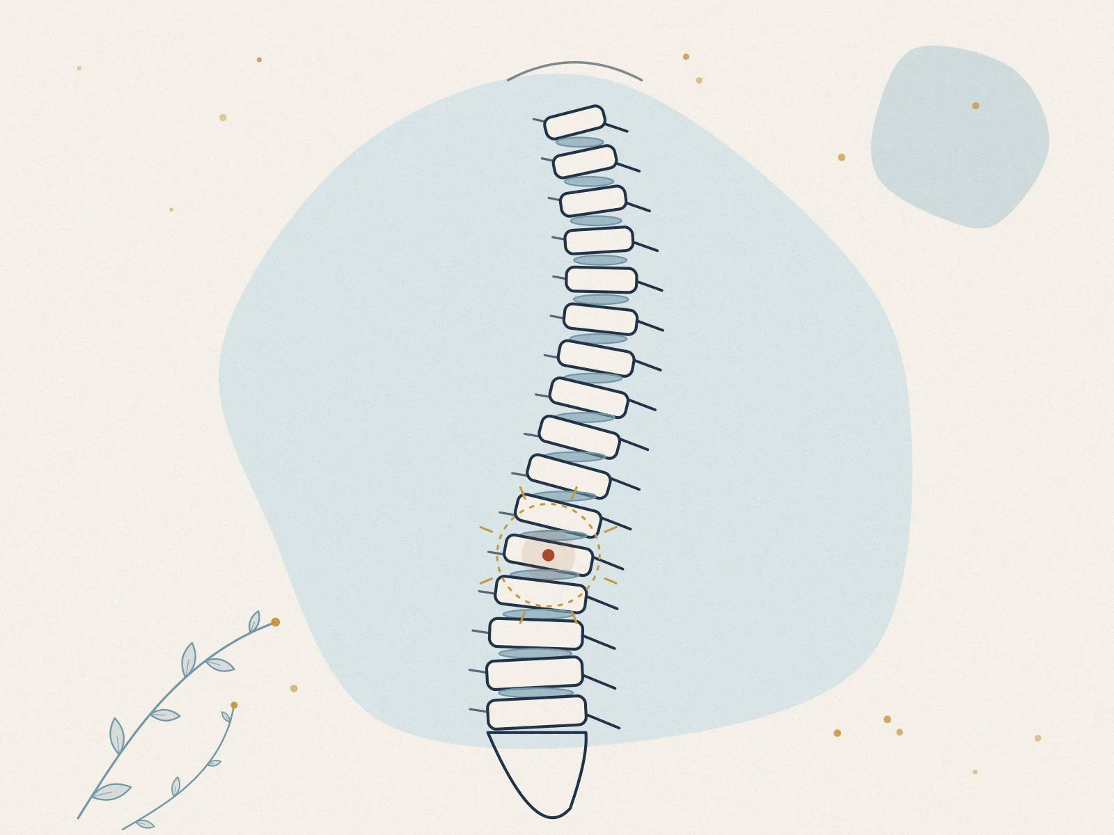 Illustration of back pain, treated at Omnia Lifestyle clinic in Chiswick, West London