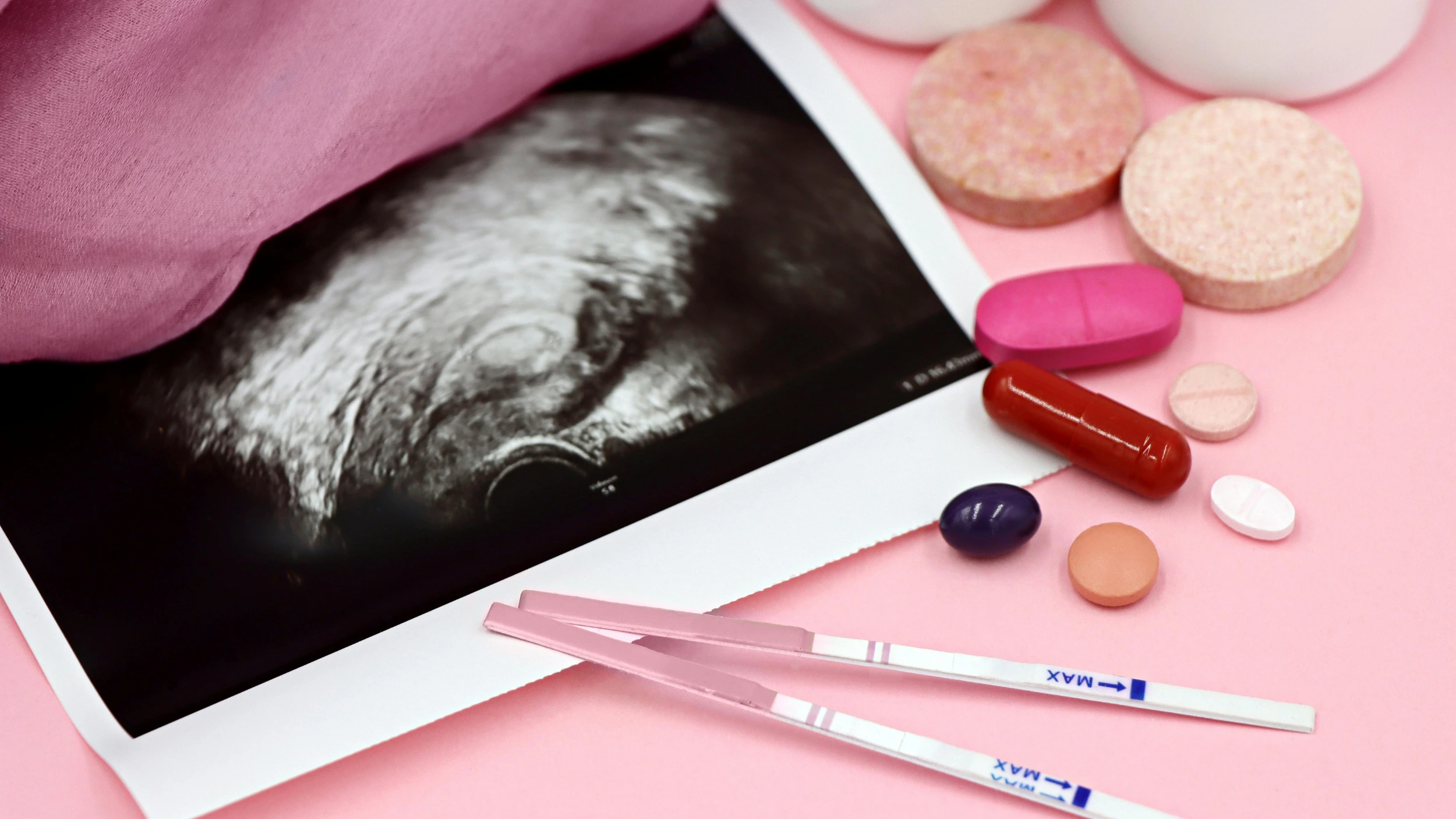 A flat-lay photograph on a pink background featuring a medical ultrasound scan printout, two fertility or pregnancy test strips, and an assortment of various pills and supplement tablets.