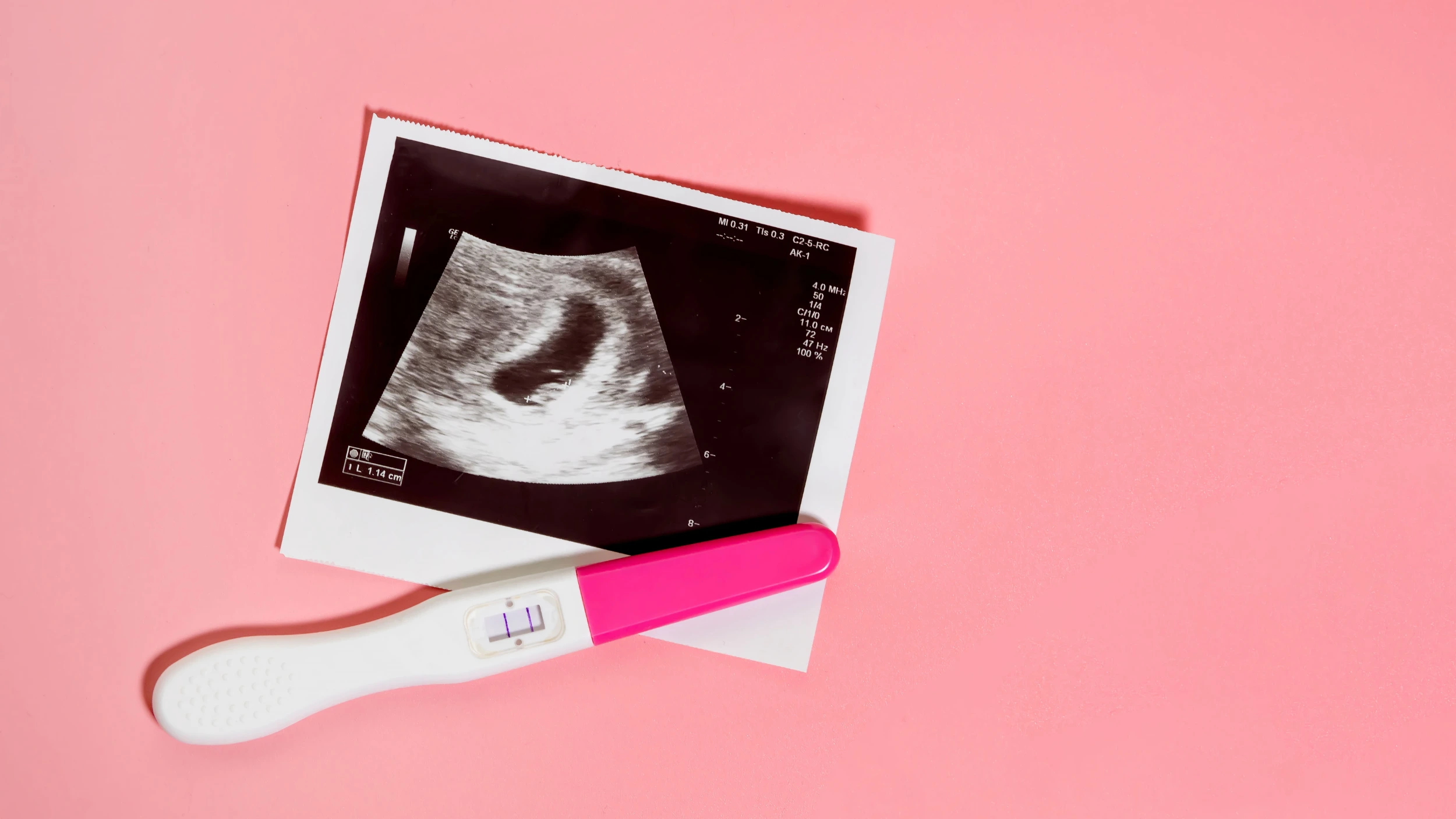 ultrasound and pregnancy test