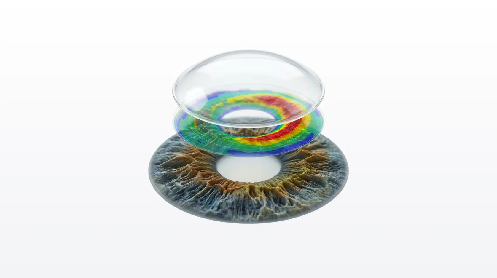 Mappa topografica della cornea con lente a contatto sopra l'iride, applicazione lenti a contatto Ottica del Borgo