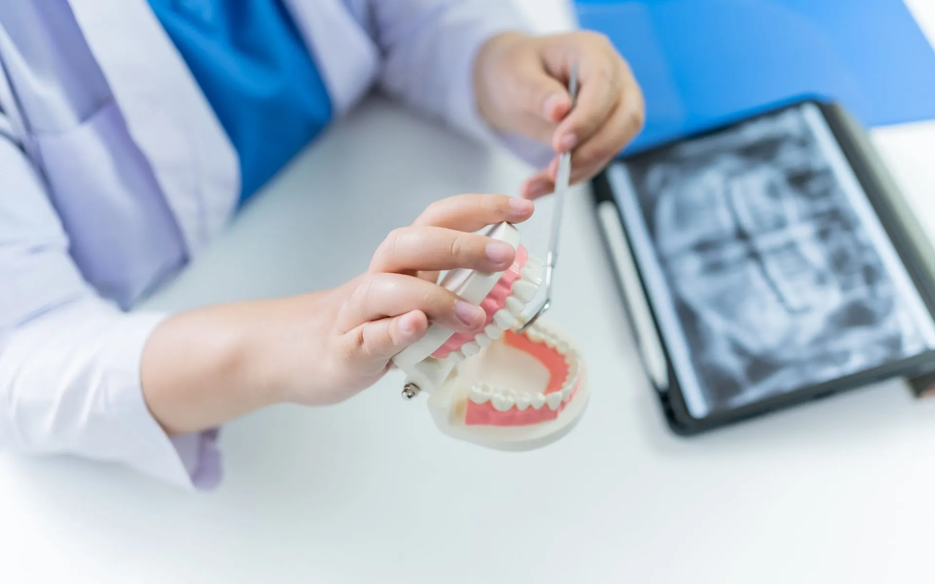 Dentist showing dental model to patient