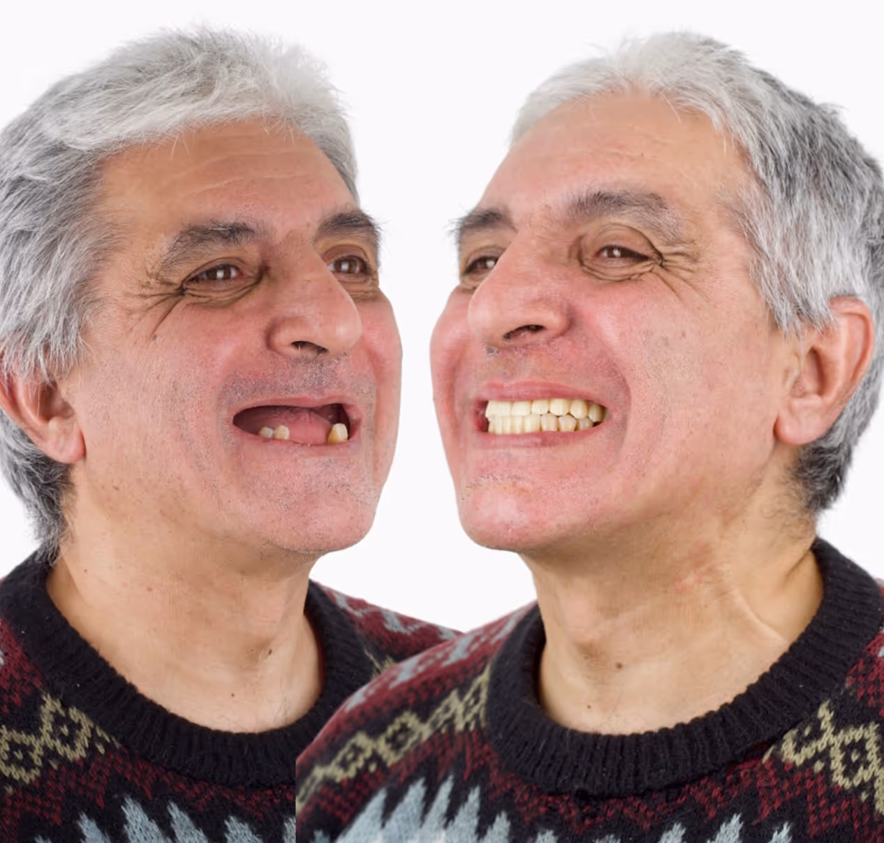 Paciente en consulta odontológica en Zuro Dental Recoleta