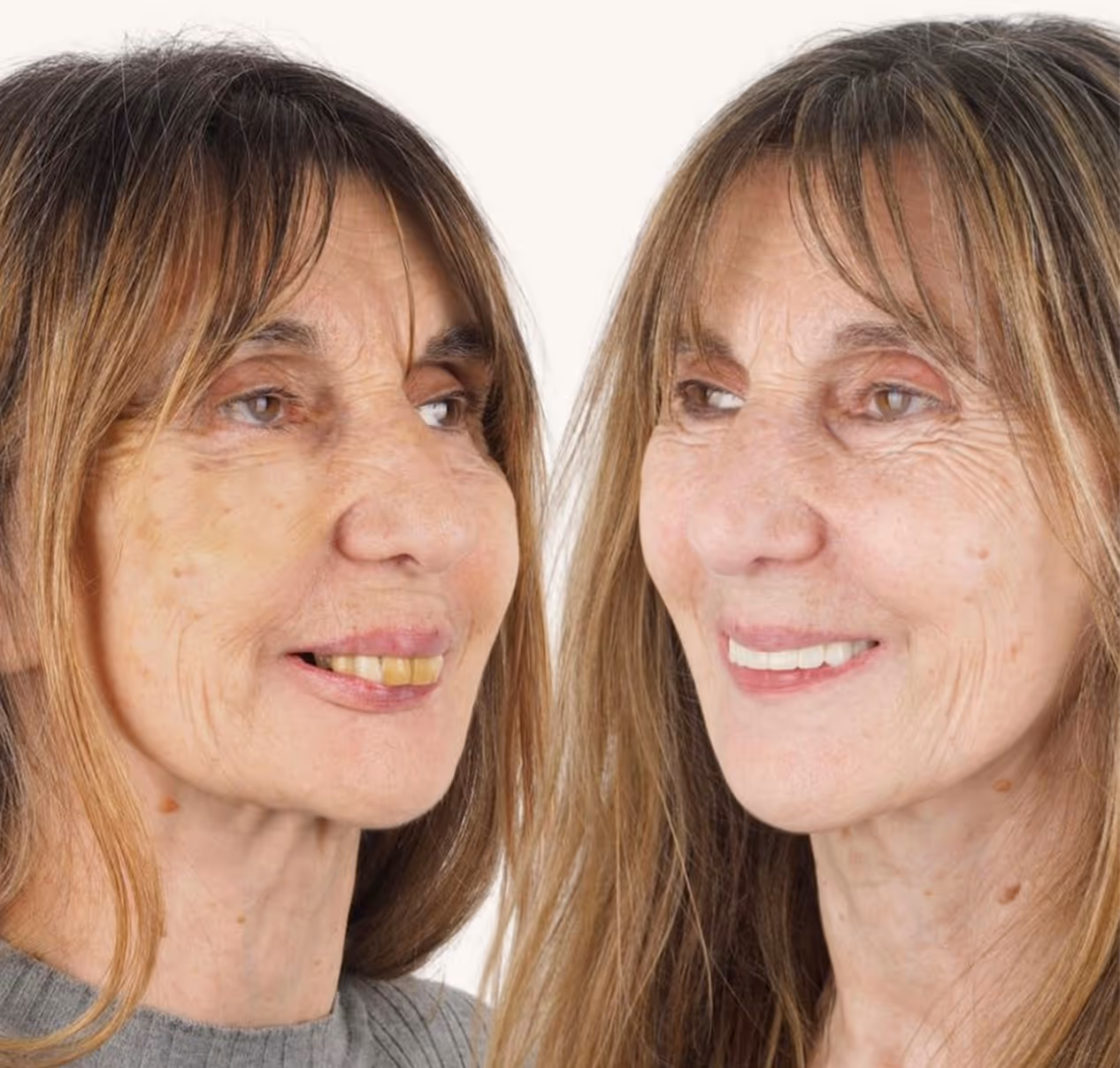 Atención profesional en consultorio de Zuro Dental Recoleta