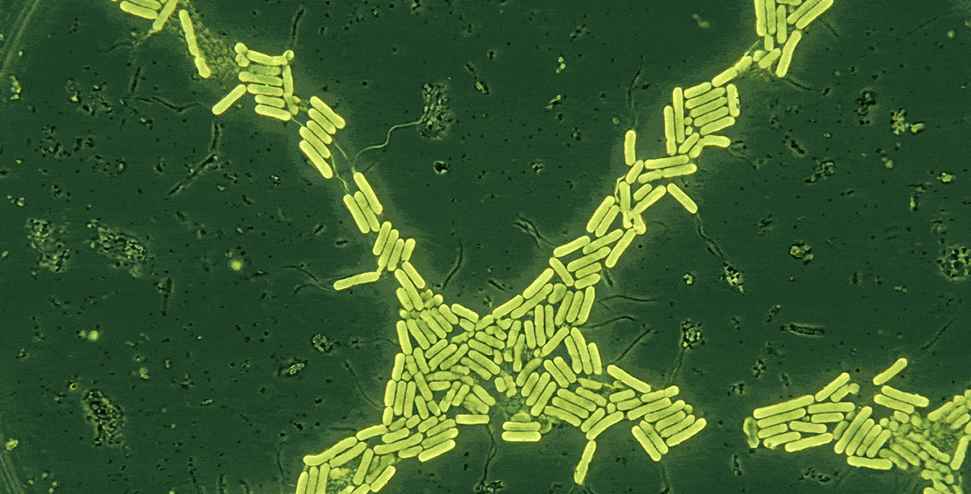 Microscopic view of yellow rod-shaped bacteria clustered and linked in chains on a dark green background.