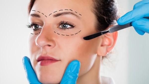 eyebrow-lift