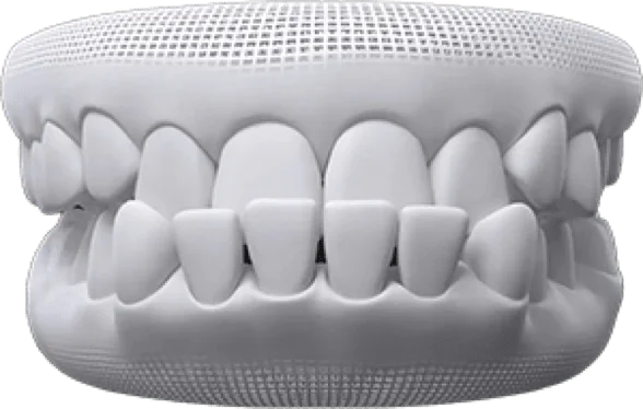 3D rendering of a set of upper and lower teeth with a biting surface visible.