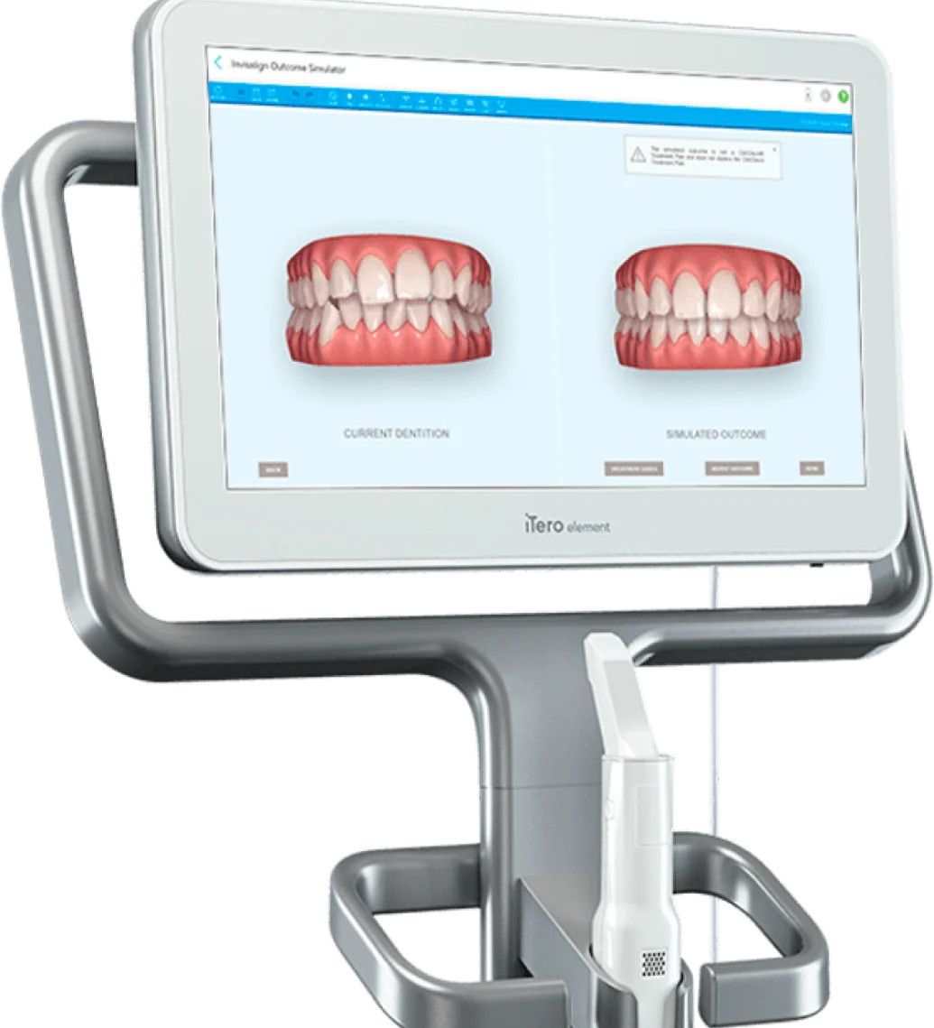 iTero device screen showing Invisalign Outcome Simulator with current and simulated dental alignments.