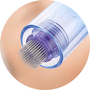 Microneedling mit Radiofrequenz im Kosmetikstudio Wien