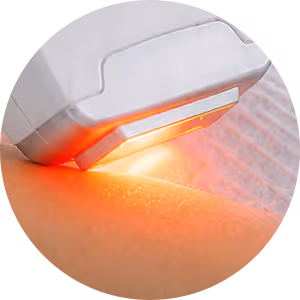 IPL Haarentfernung Wien – glatte Haut ohne Rasur