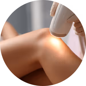 IPL Haarentfernung Achseln Beine Bikini – schonende Methode Wien