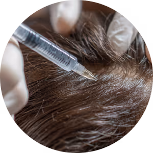 PRP Therapie Haare – stärkere Haarwurzeln und dichteres Haar