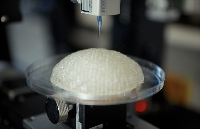 A photo of Conexeu Sciences 3D printing its BREAST implant.