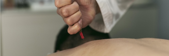 injection session treatment