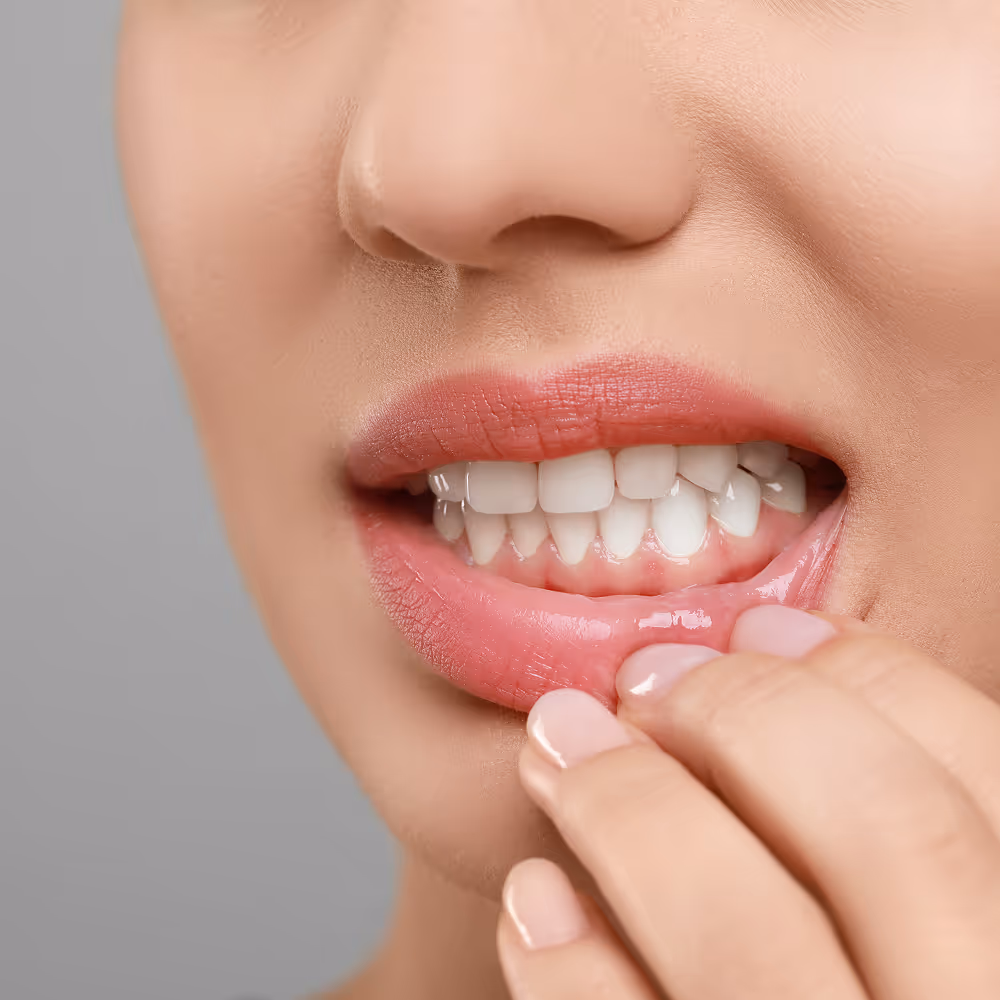 Close-up of healthy gums after professional periodontal treatment, showing reduced inflammation and improved gum health