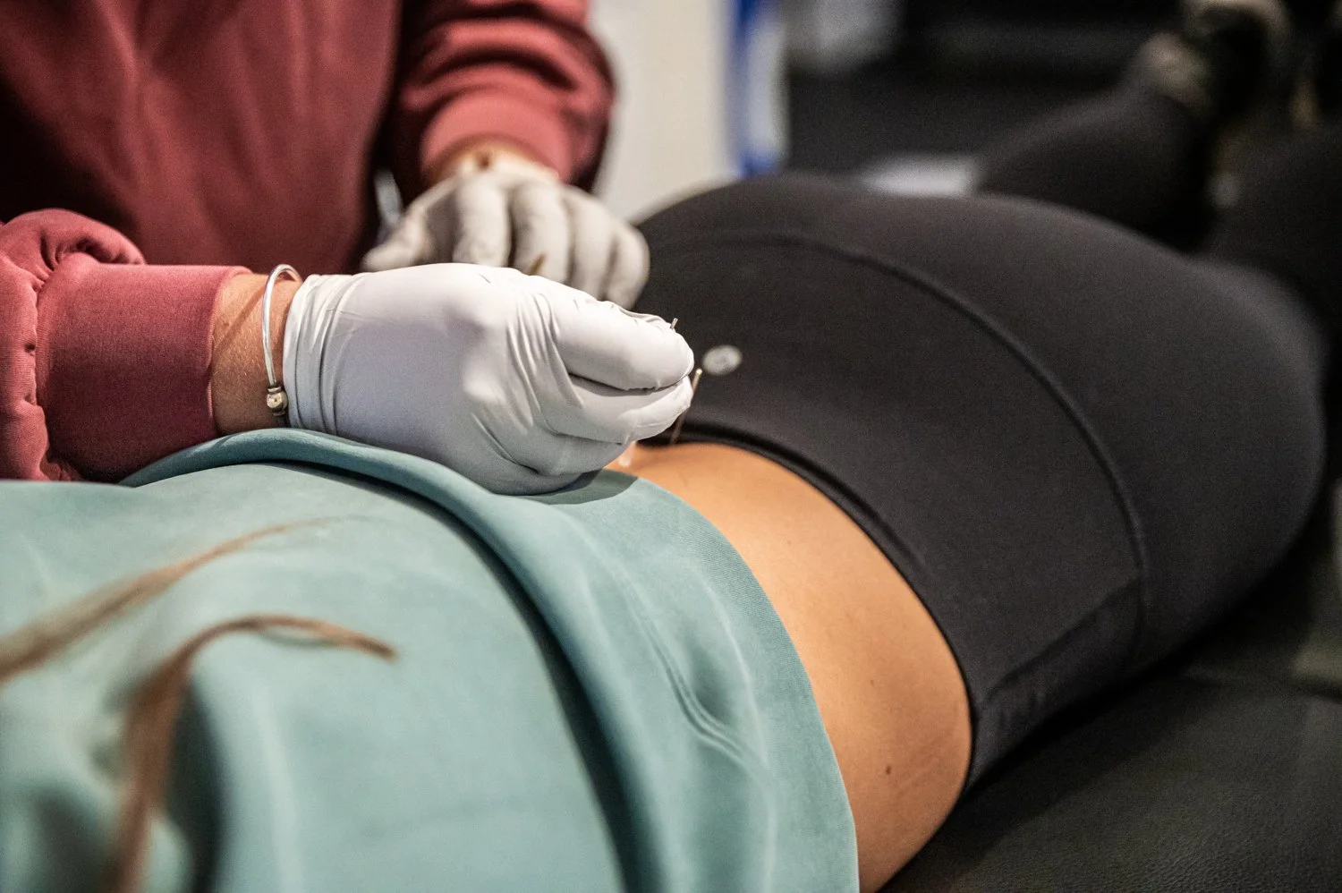 Boston Dry Needling