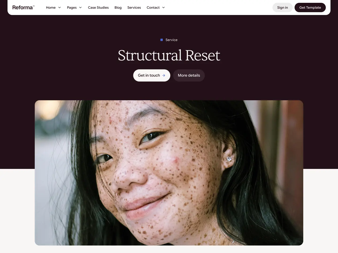 Service Single (CMS)