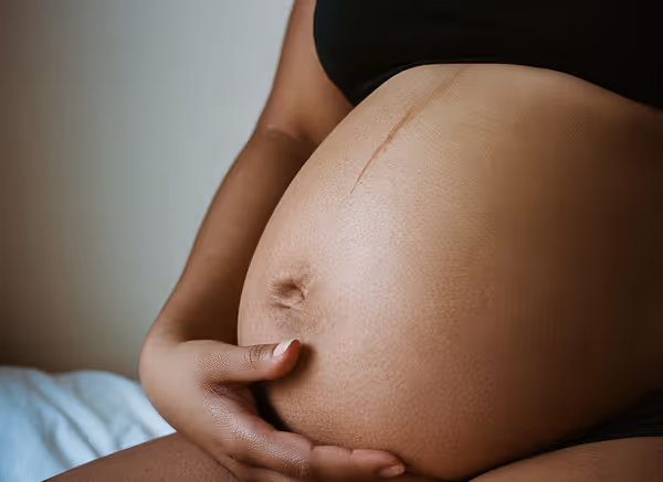 Närbild av gravid kvinnas mage med en hand som vilar på den och en synlig linea nigra.