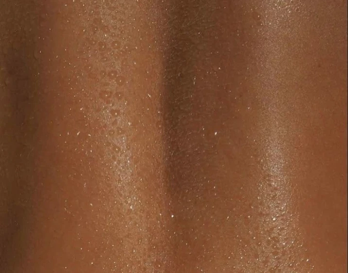 Transpiration excessive