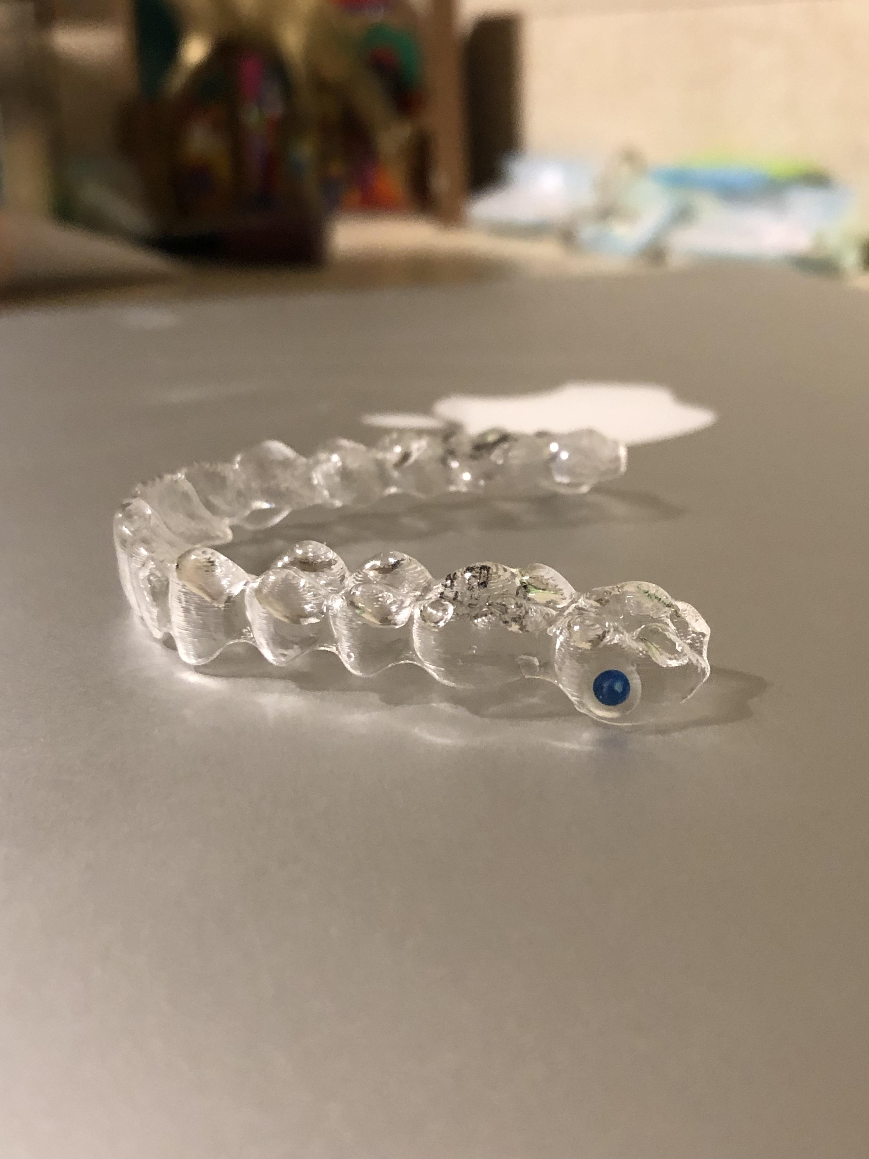 Invisalign with blue dot